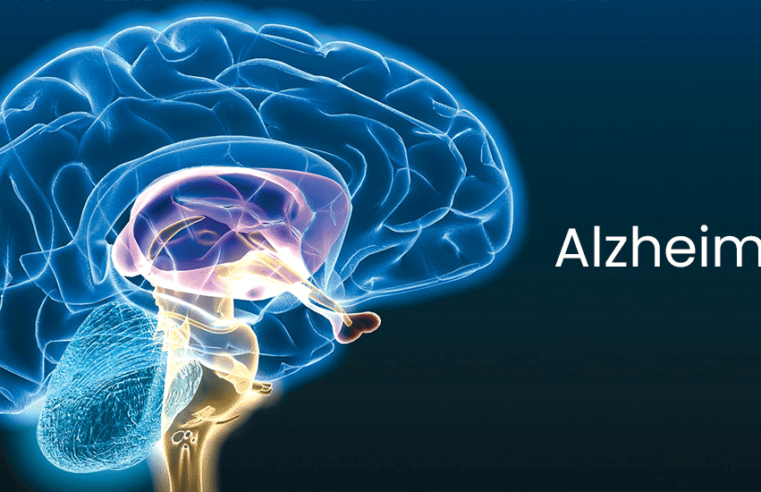 Alzheimer: será que é possível prevenir?