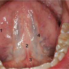 E-book com o título ‘perfil imunológico de doenças da cavidade oral’