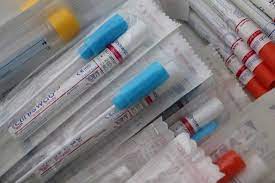 Montes Claros solicita testes rápidos para influenza