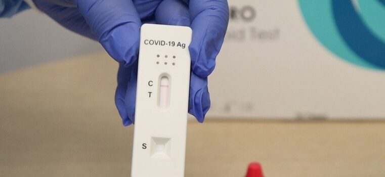 Minas Gerais distribui mais de 1 milhão de testes rápidos de Covid-19