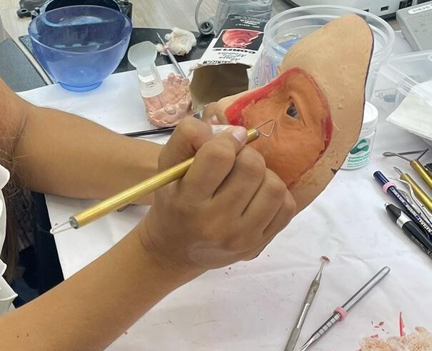 Startup incubada na Inemontes colabora para devolver qualidade de vida a pessoas que sofrem mutilação facial devido ao câncer