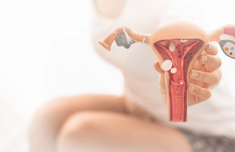 Radiologista fala sobre a endometriose e esclarece cuidados necessários