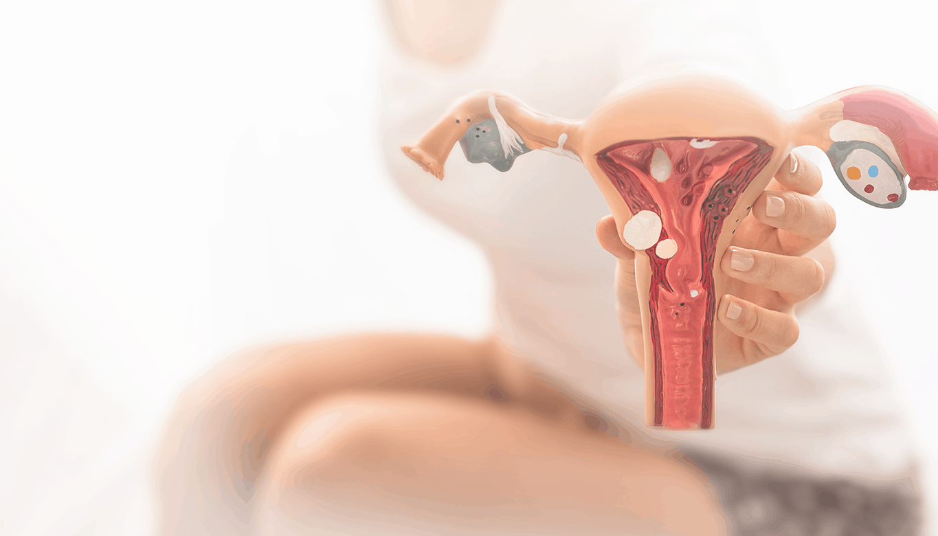 Radiologista fala sobre a endometriose e esclarece cuidados necessários